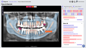 Pano AI Report GERM