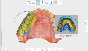 Impression-scanning