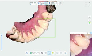 MEDIT-i700_Brochure_2021