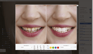 Medit-Smile-Design