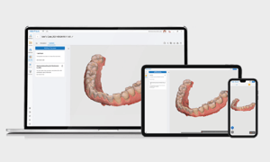Web-Viewer-and-Case-Talk