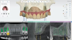 Dental-system-dental-axess