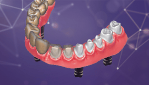 Exocad-DentalCAD-350x201
