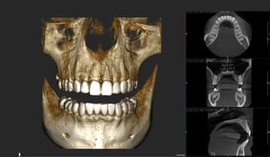 X-MIND optima 3D Bsp 85_9_case-1