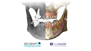 XMO 3D AIS RealGuide