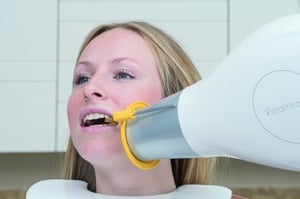 Duerr_Unterkiefer_Molar_links-350x233