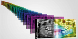 S-Pan-Technologie-1-350x177