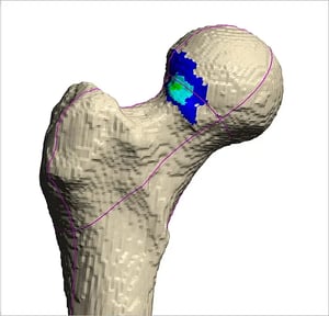 Assets-Hipmap-Hipcheck3DBone