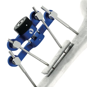 TrueLok-Elevate-Feature-Image