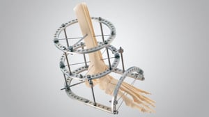 TrueLok-Primary-960x538-1