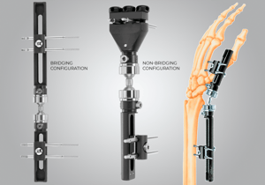 Pennig-Dynamic-Wrist-Fixator-Primary-1-1536x1080