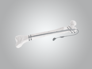 Fitbone-Trochanteric-Primary-300x225
